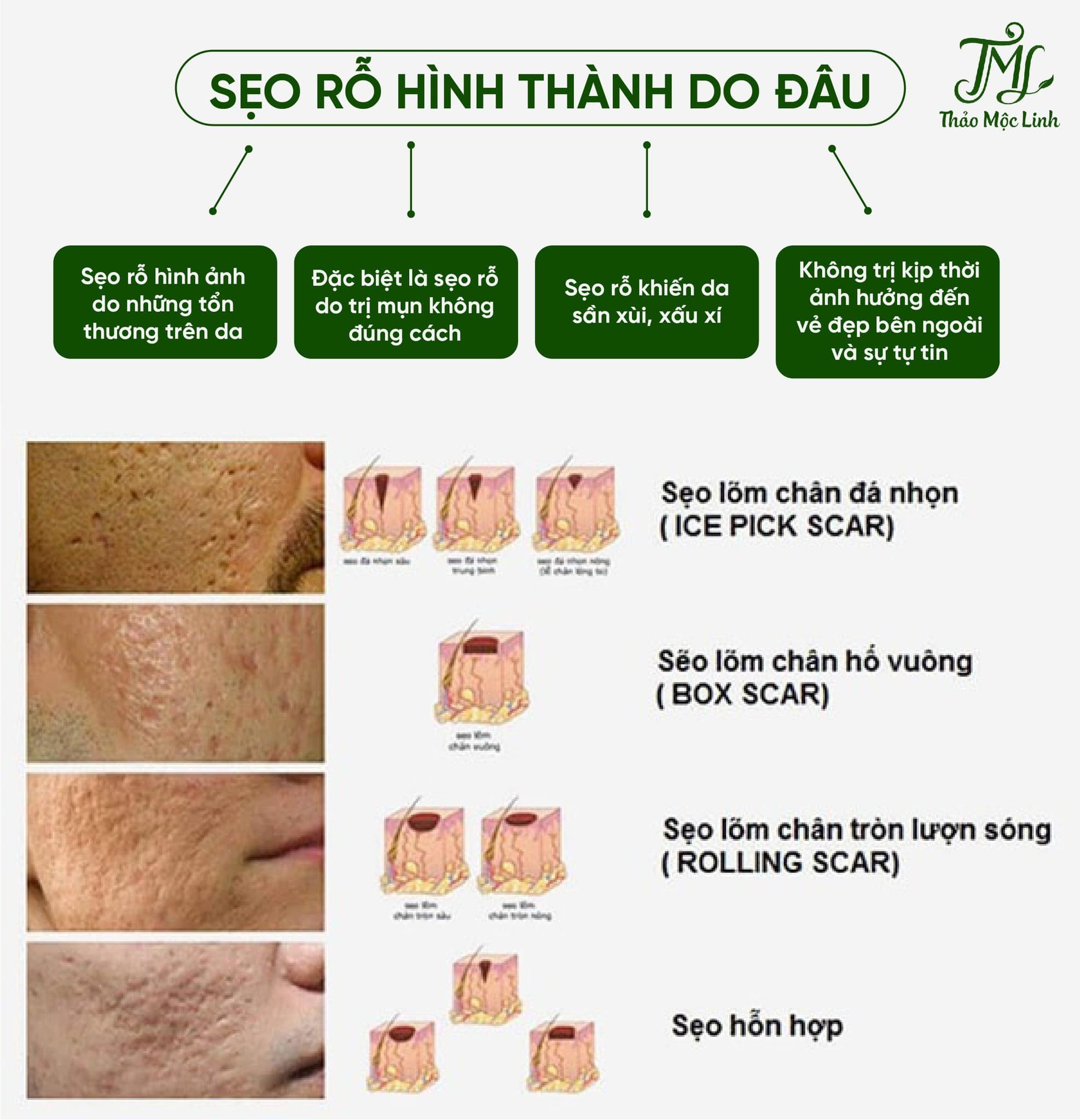 Đông Y Thảo Mộc Linh