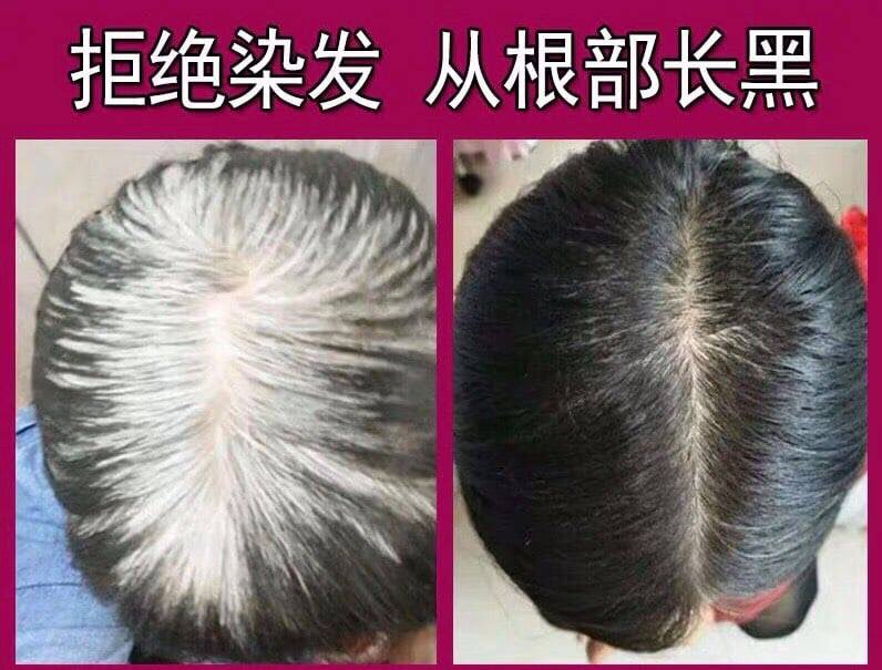 Dầu Hà Thủ Ô phục hồi tóc bạc, đen mượt tóc, sạch gàu kích thích mọc tóc
