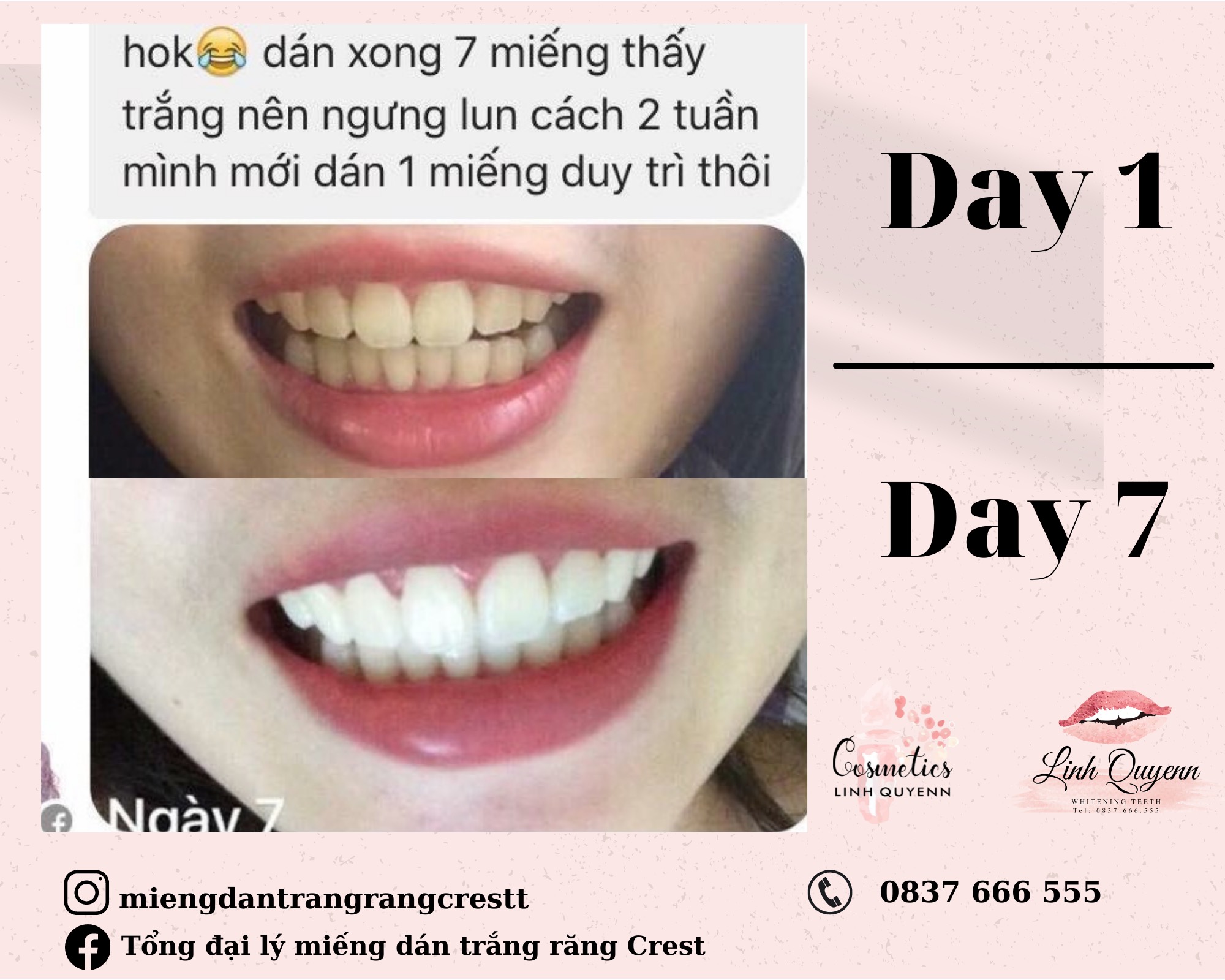Kem đánh răng Crest Baking Soda & Peroxide Whitening 161G - Làm trắng răng