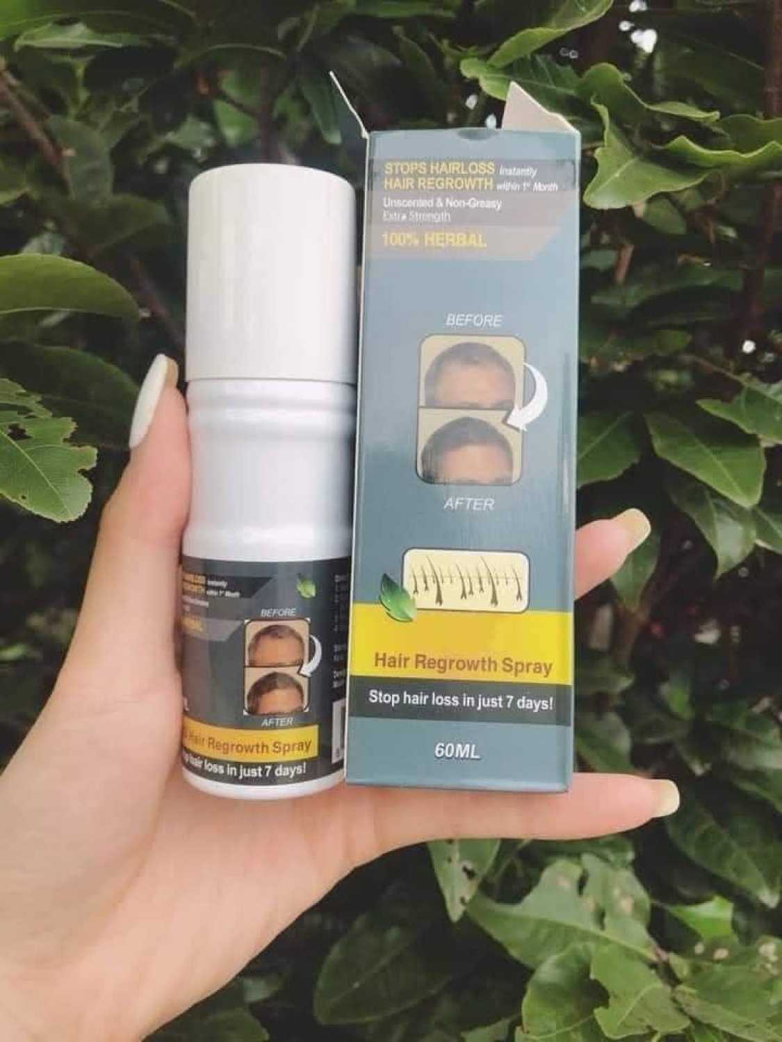 XỊT KÍCH MỌC TÓC GIÚP TÓC DÀI VÀ KHỎE