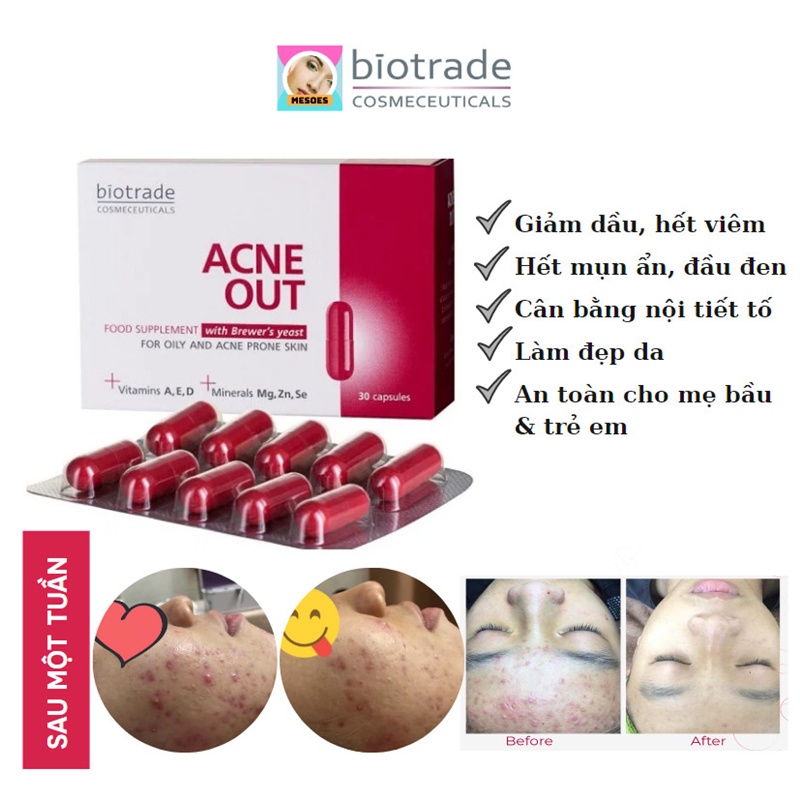[CHÍNH HÃNG] Viên Uống Biotrade Hỗ Trợ Đẹp Da