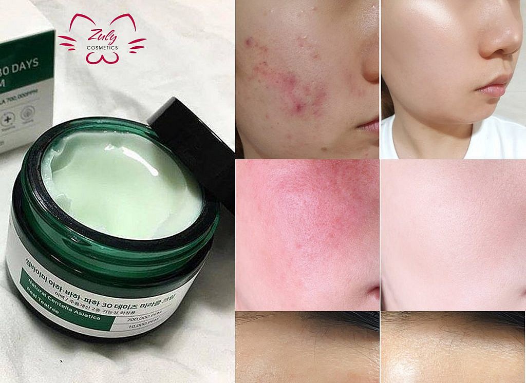 [HCM]Kem Dưỡng Some By Mi AHA BHA PHA 30 Days Miracle Cream 50ml