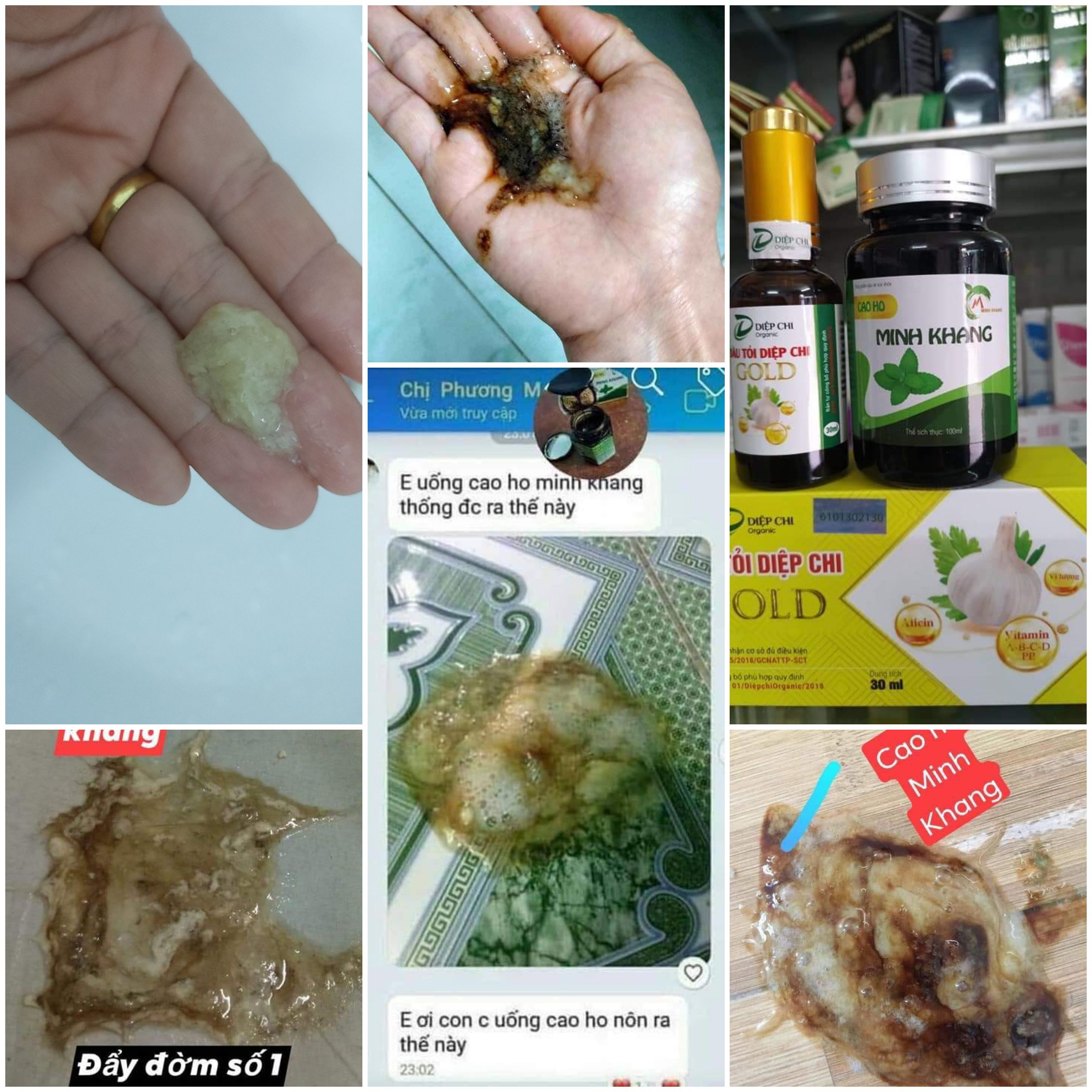 [HCM]Combo Dầu Tỏi Diệp Chi + Cao Ho Minh Khang