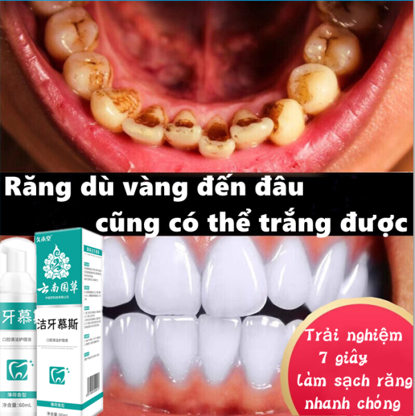 YaMei Mousse trắng bạc hà ,Răng trắng chói  ,vết khói và vết trà ,hôi miệng ,Cải thiện các vấn đề khoang miệng khác nhau bằng súc miệng +đánh răng  thay vì kem đánh răng ,tăng gấp đôi hiệu