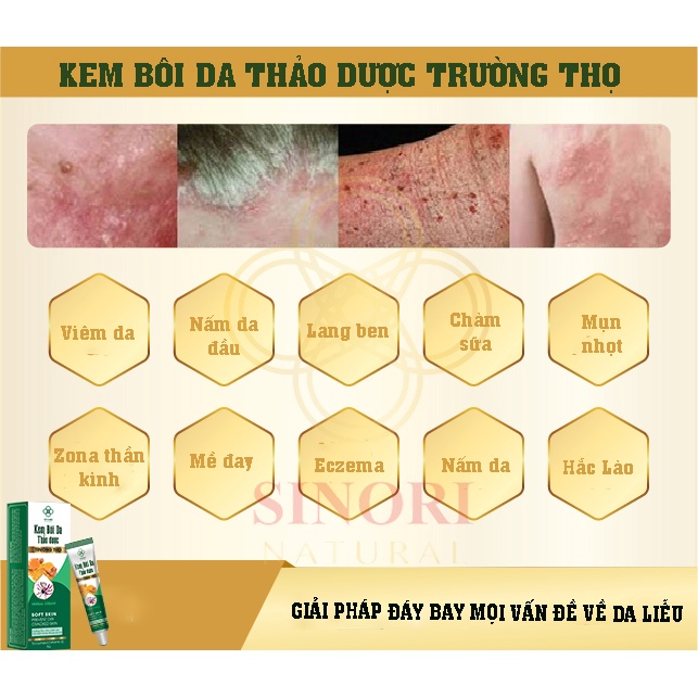KEM BÔI DA THẢO DƯỢC SINORI