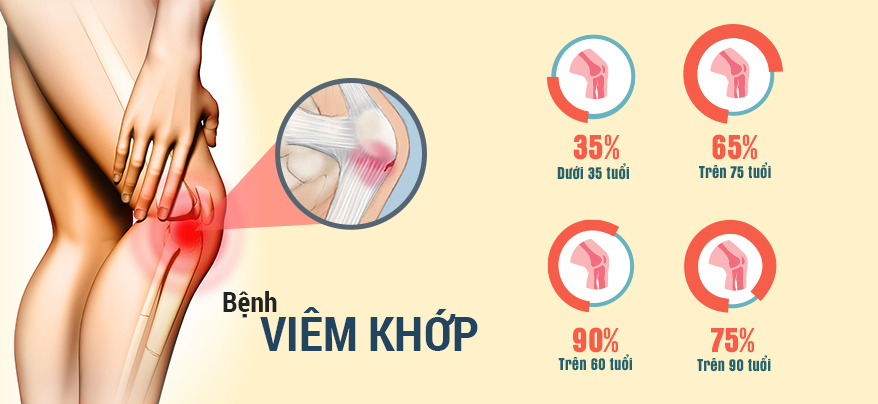 TINH DẦU THẢO DƯỢC VUA TRỊ KHỚP