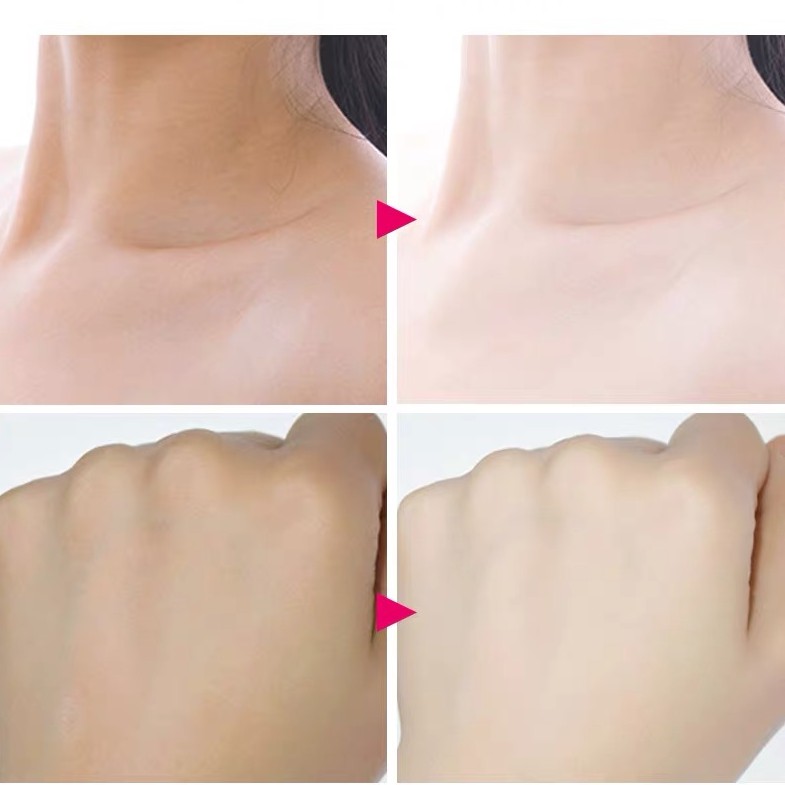 Kem Dưỡng Trắng Da V7 Toning Light Bioaqua