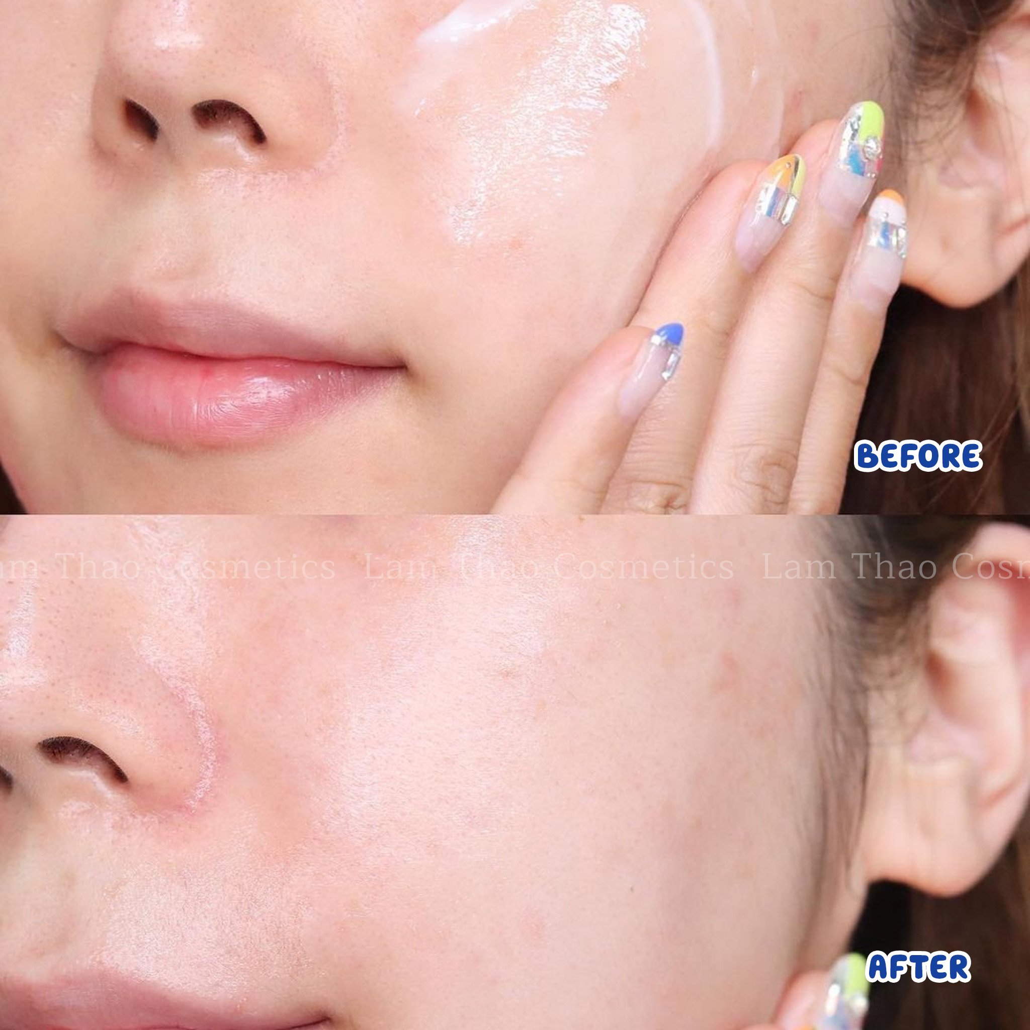 Kem Dưỡng La Roche-Posay Effaclar Duo (+)