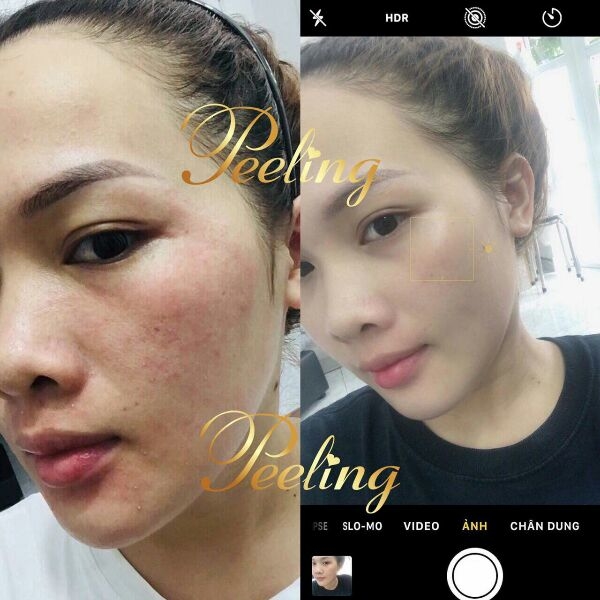 Mẫu mới - Kem Peeling Tái Tạo Da Mặt.