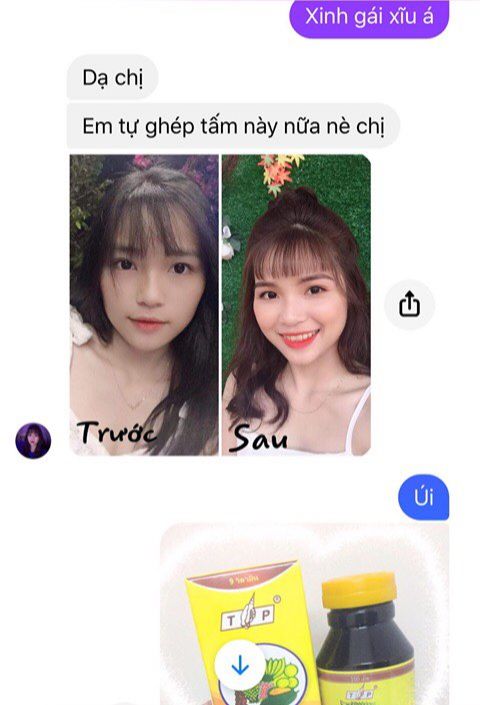 Vitamin Tăng Cân Thái Lan Có Mã Check