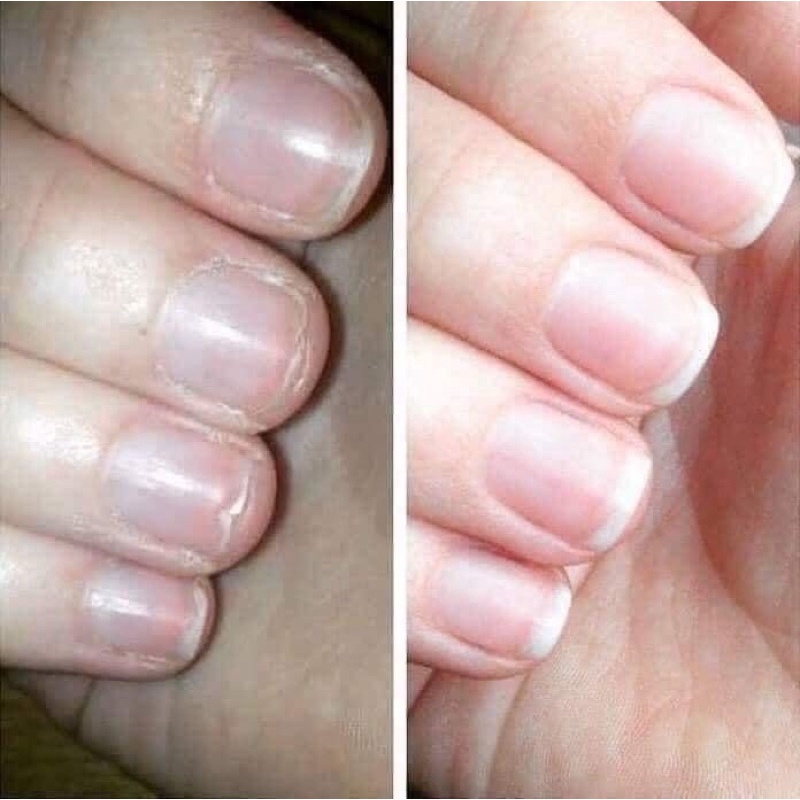 Dưỡng Móng Độc Quyền, Giúp Dài Móng, khoẻ, bóng,hồng