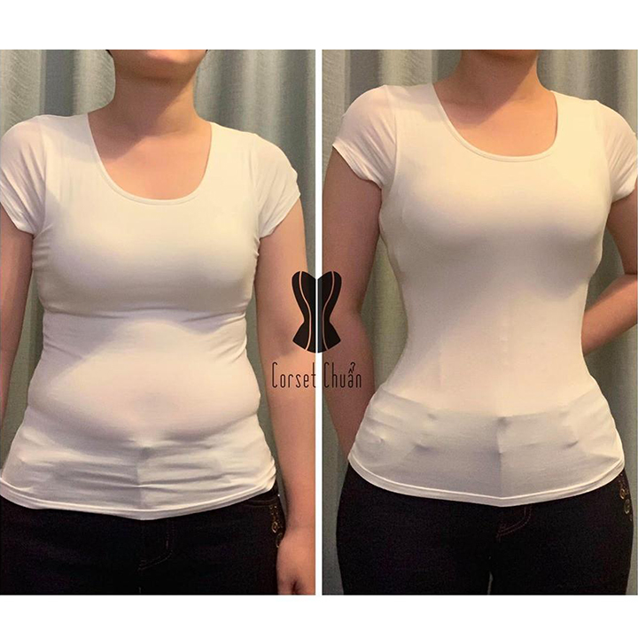 Đai nịt bụng định hình và giảm mỡ vòng eo dành cho chị em phụ nữ