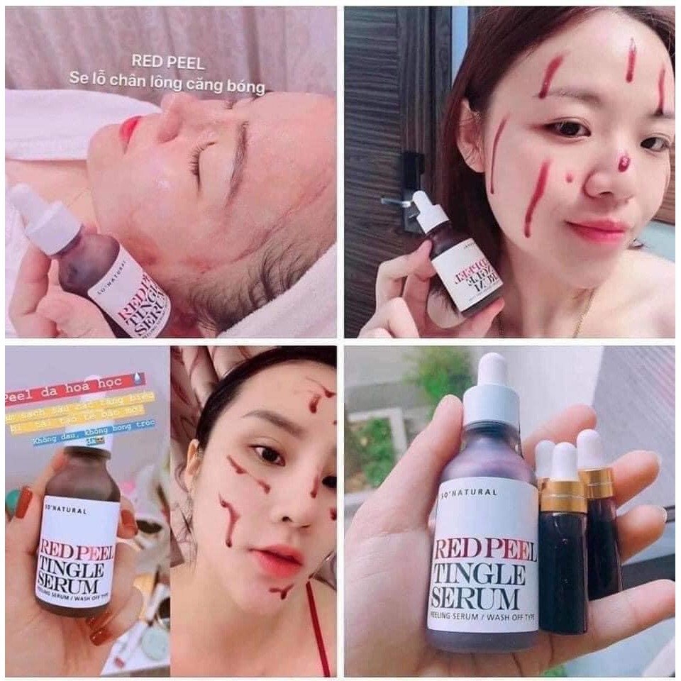 Serum Red Peel Tingle Thay Da Phục Hồi Sinh Học 35ml