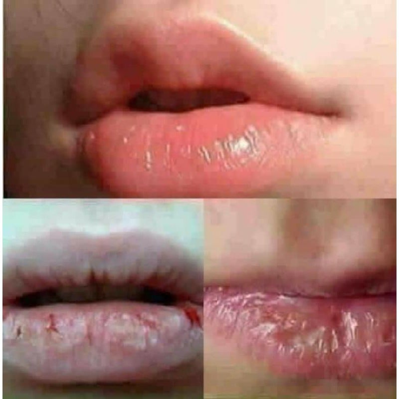 Ủ Môi Honey Athena chống khô môi, nẻ môi