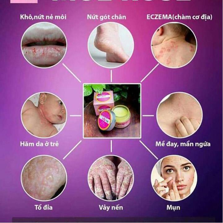 [HCM]Kem đa năng Mul Rose 30gr