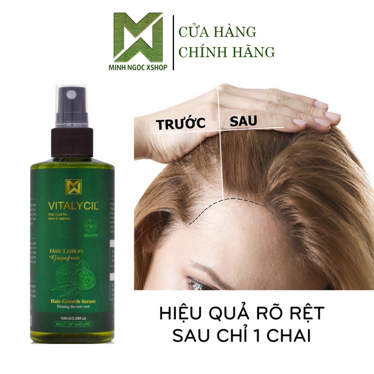 Xịt bưởi chống rụng, kích mọc tóc Vitalycil 100ML