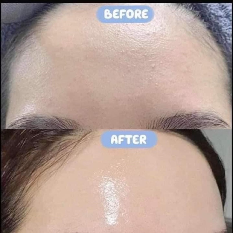 Tinh Chất Phục Hồi, Cấp Ẩm Smas Pro Vitamin B5 Hydra Serum