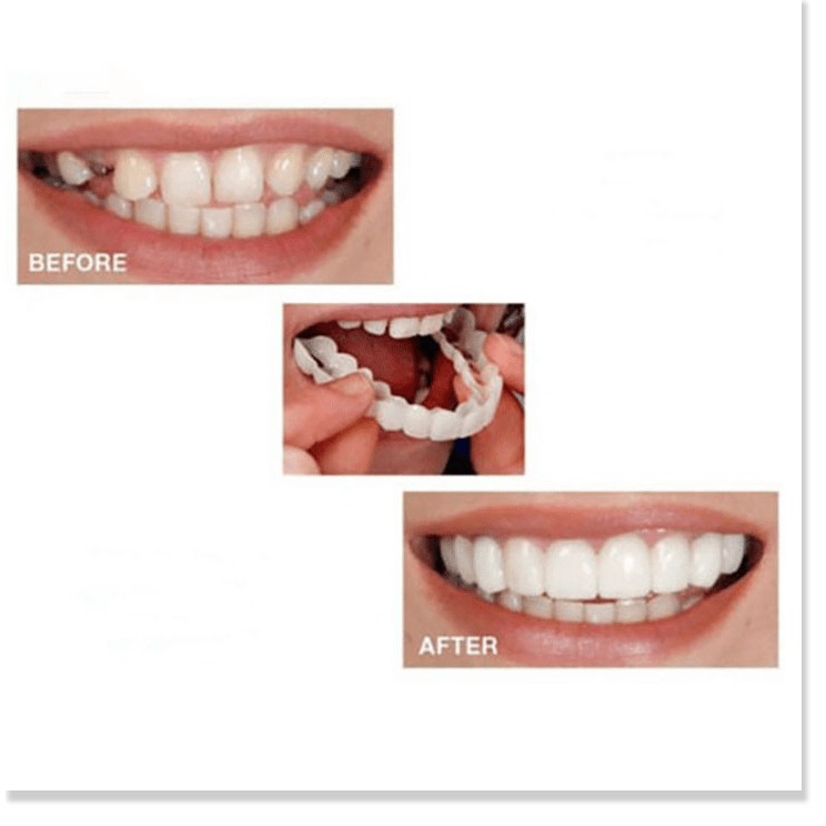 False teeth snap on smile kmdeal