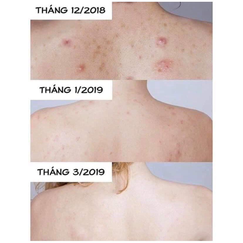 Xà phòng giảm mụn lưng Pelican For Back 135g