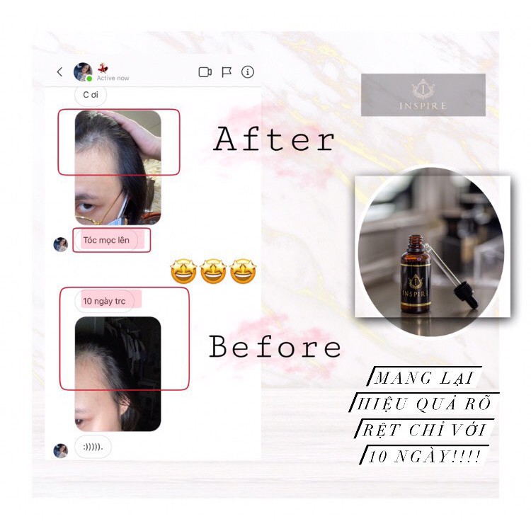 Serum INSPIRE Dưỡng Kích Thích Mọc Tóc