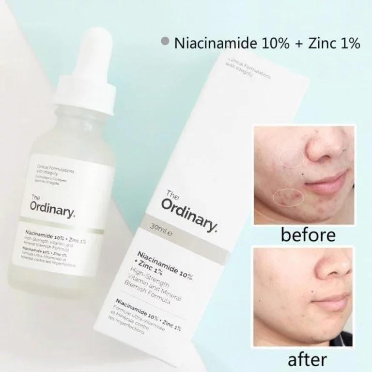 Tinh chất THE ORDINARY Niacinamide10%+Kẽm 30ml