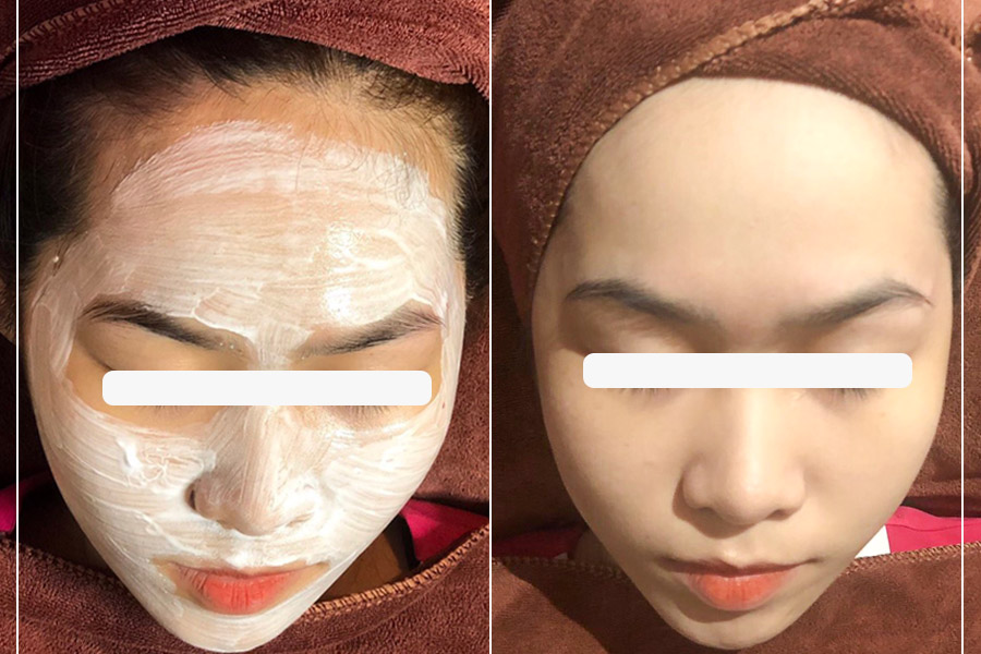 Mặt Nạ Ủ Trắng Huyết Yến Collagen - Giúp tái tạo collagen và gia tăng độ đàn hồi cho da, dưỡng da căng mịn, TRẮNG hồng, bật 2,3 tone ngay lần ủ đầu tiên