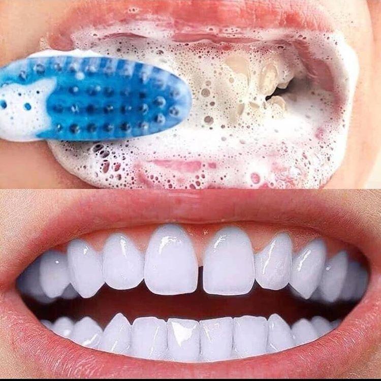 [HCM]COMBO 2 lọ kem đánh răng bakingsoda vị hoa quả