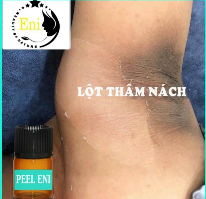 [HCM]PEEL LỘT TRẮNG DA NÁCH. HẾT THÂM(Tặng kem dưỡng)