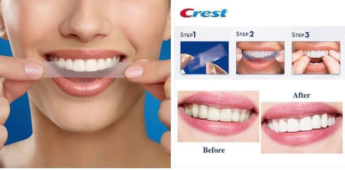 Miếng dán trắng răng Crest 3D WHITESTRIPS