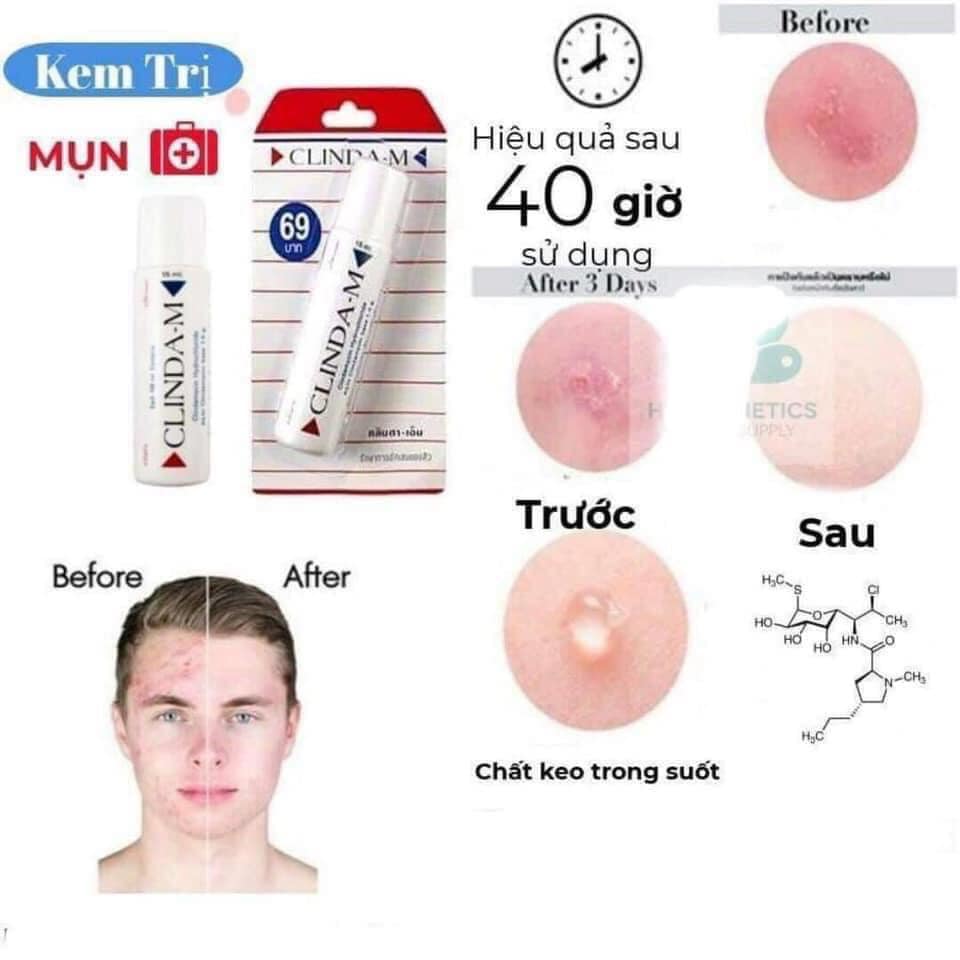 Serum chấm mụn Clinda M 15ml THÁI LAN