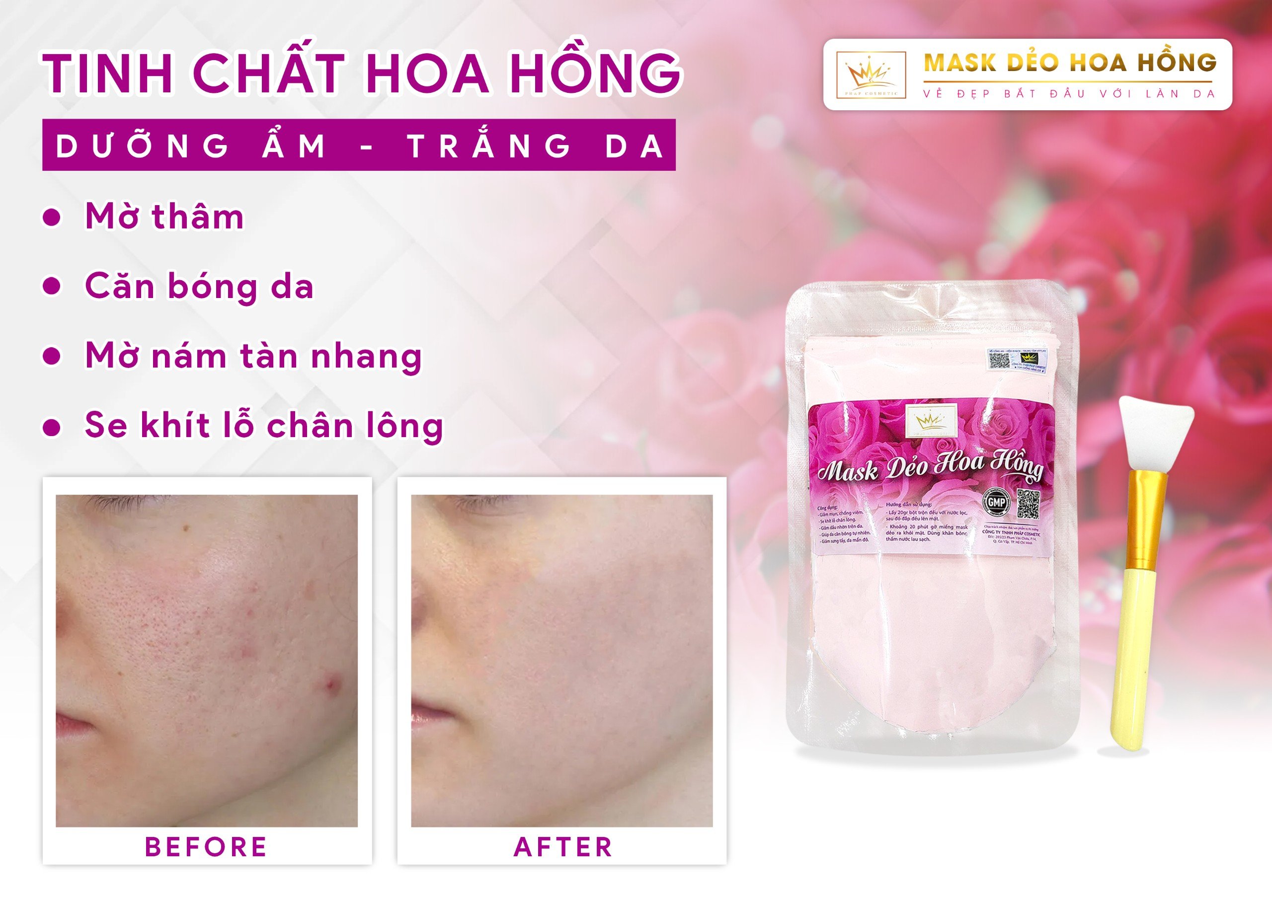 Mask hoa hồng Pháp