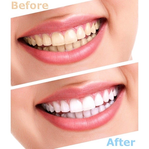 COMBO 02 Tuýp Kem Đánh Răng Hắc Sâm Korea Black Ginseng Toothpaste 150g