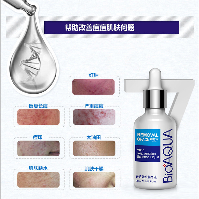 Serum giảm mụn làm mờ sẹo và dưỡng da 30ml