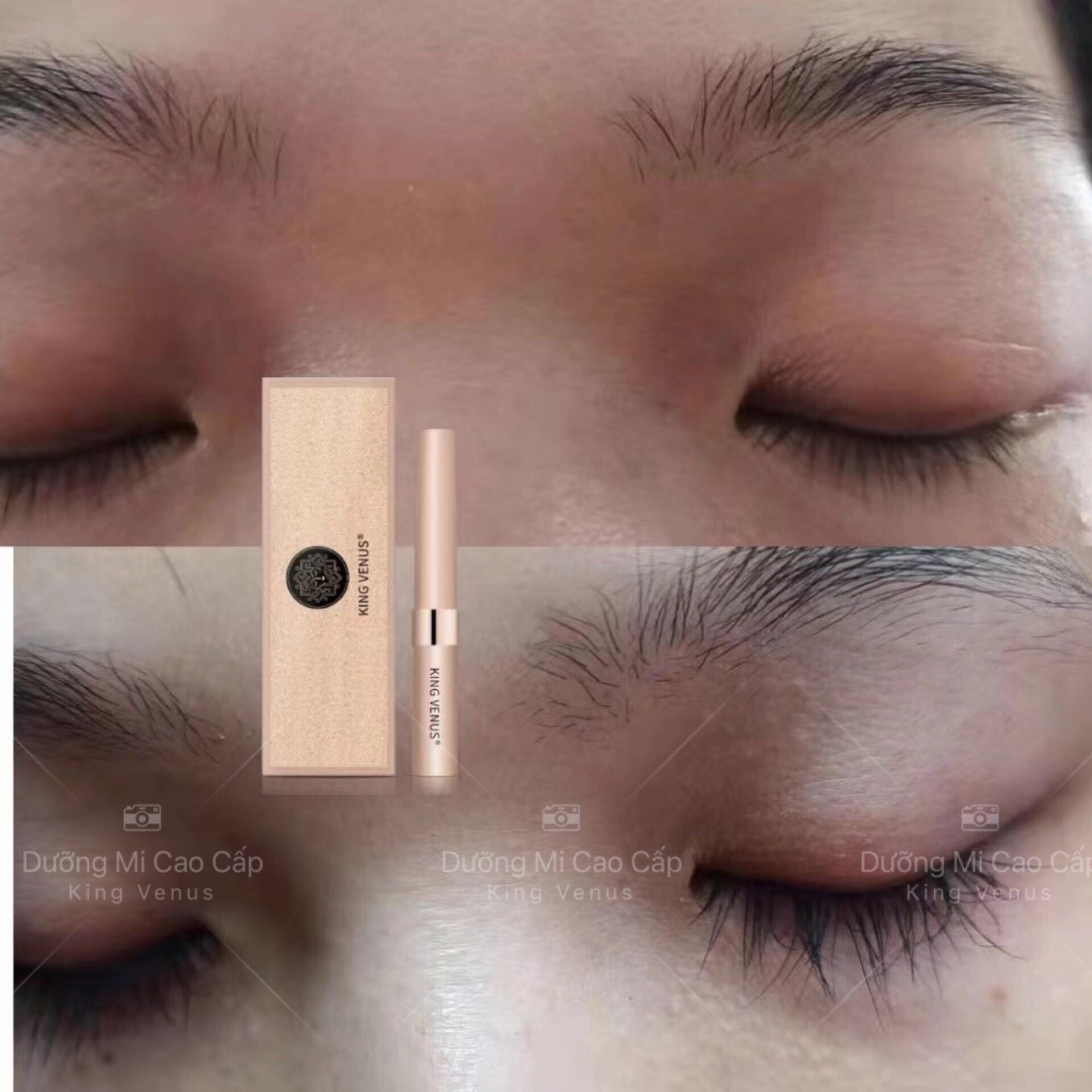 [Chính hãng] Combo Siêu Tiết Kiệm KING VENUS [Serum kích mọc tóc zzVENUS + Dưỡng mi KING VENUS (zz VENUS)]
