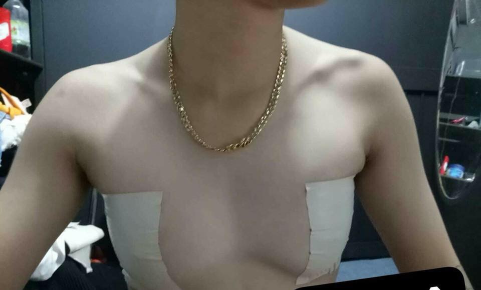 Keo Dán Ngực Nano Dành Cho Sb Tomboy Trans