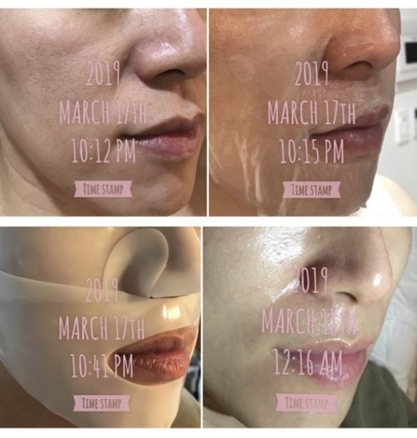 [HCM]Mặt Nạ Ma Thuật Thần Thánh Derm all Matrix (đắp để qua đêm)