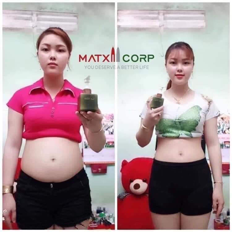 [HCM]Combo Go Detox (Mẫu Mới Nhất)
