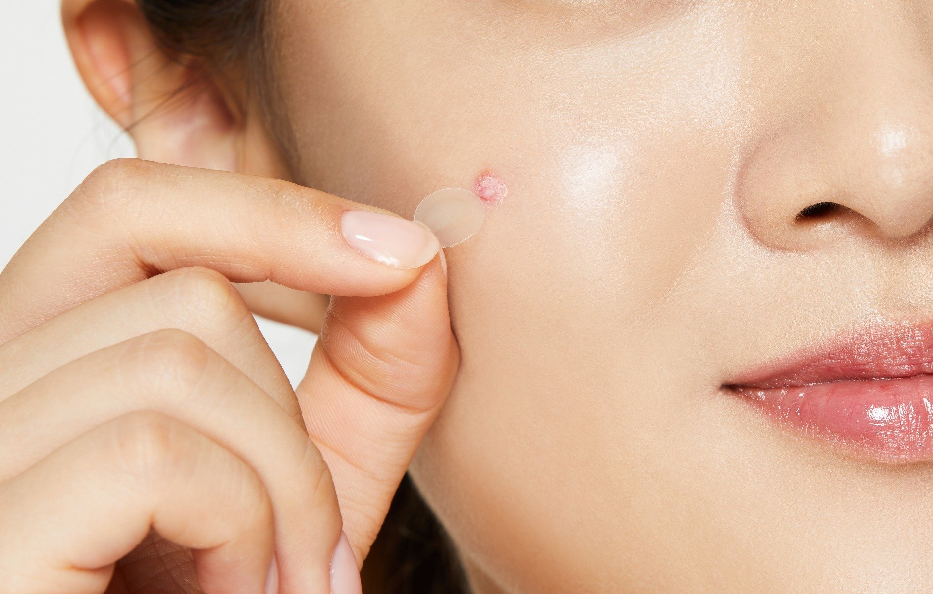 Miếng Dán Mụn Acnes Clear Patch (224 miếng)
