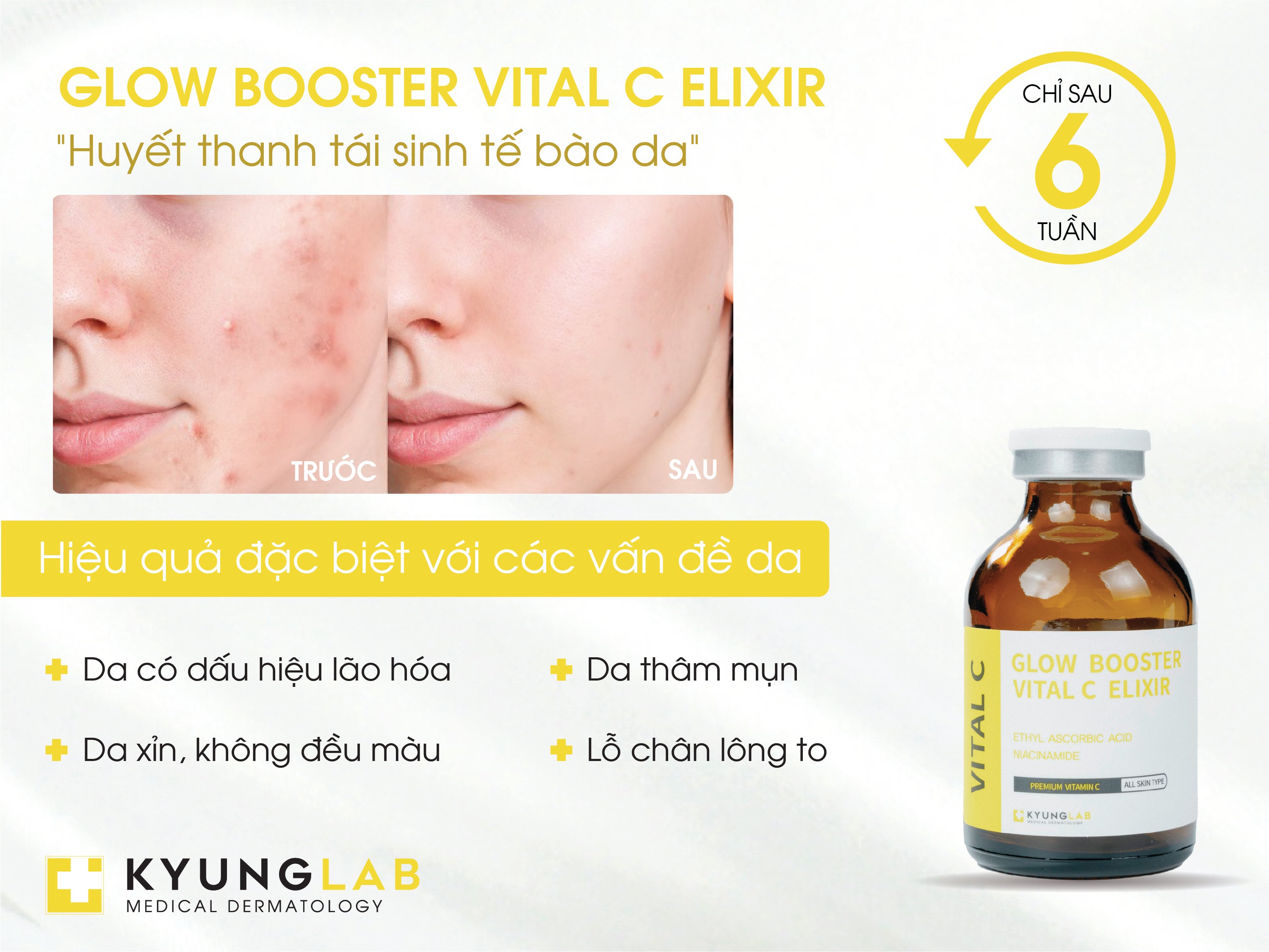 Tinh chất Vitamin C KyungLab Glow Booster Vital C Elixir 30ml