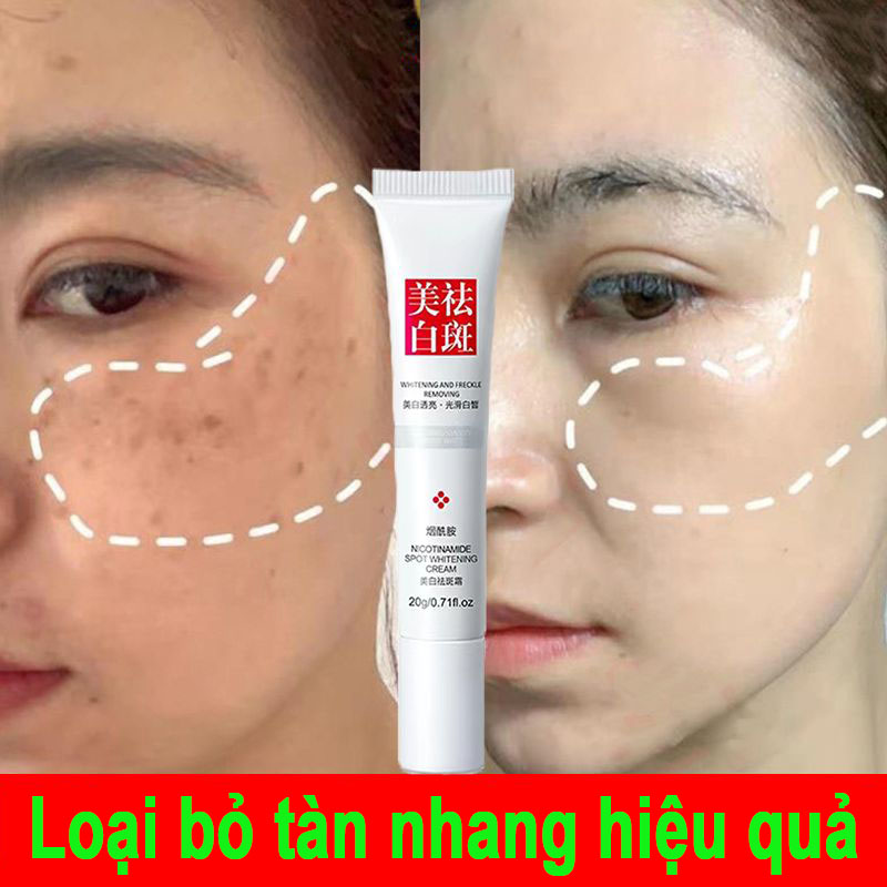 Kem chống tàn nhang Kem làm trắng Kem làm trắng Kem làm trắng da Chống sạm da Chống tàn nhang mạnh mẽ Chăm sóc da mụn Chống nắng Chống tàn nhang Làm trắng Kem làm trắng tự nhiên / làm trắng Làm trắng