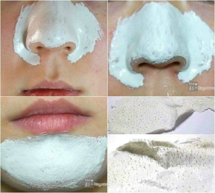 Mặt Nạ Lột Mụn Cám, Đầu Đen Queen 50g