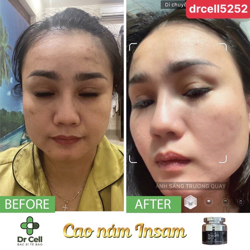Cao Nám Insam Dr Cell