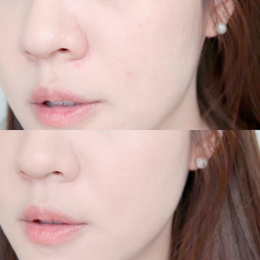 Tẩy da chết hoá học The Ordinary AHA 30% + BHA 2% Peeling Solution
