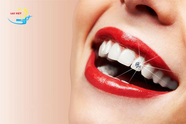 [HCM]hạt đính đá trên răng bộ 5 hạt + keo