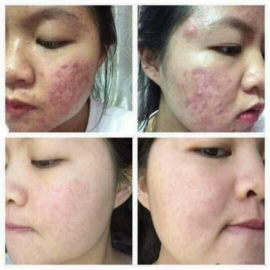 thao duoc 100ml