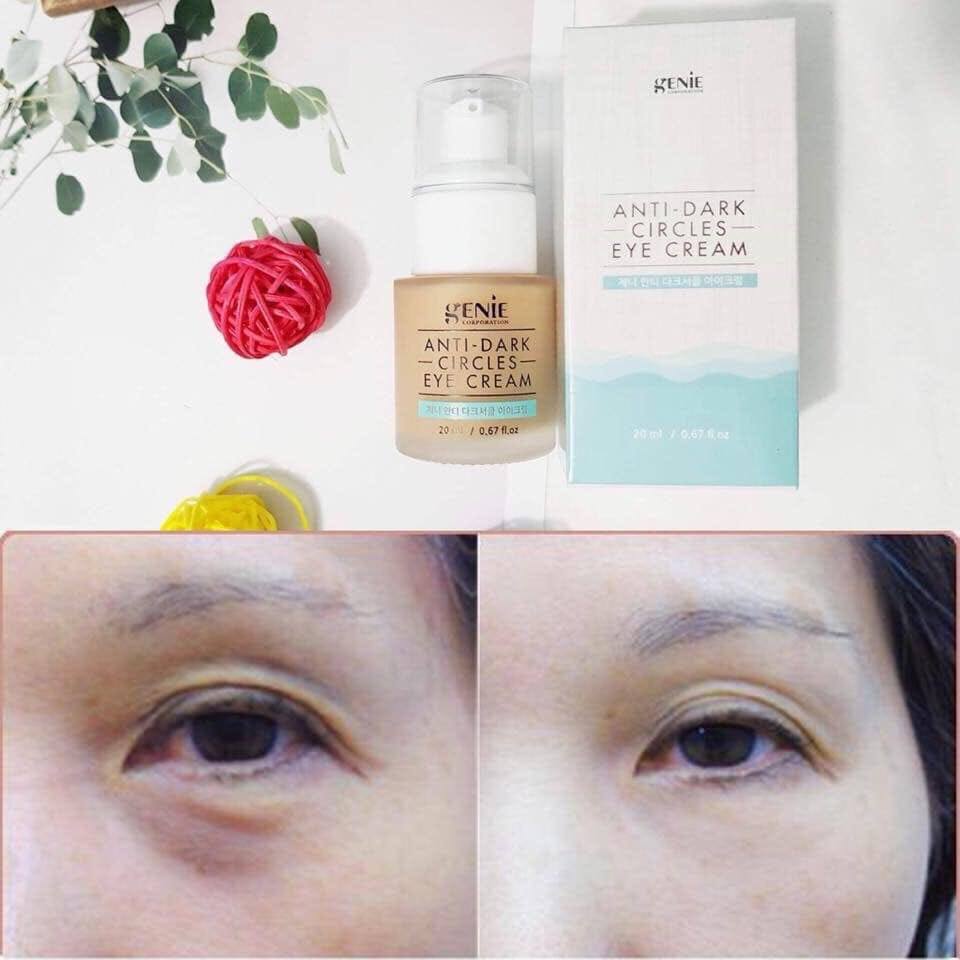 KEM TRỊ THÂM MẮT GENIE 20ml