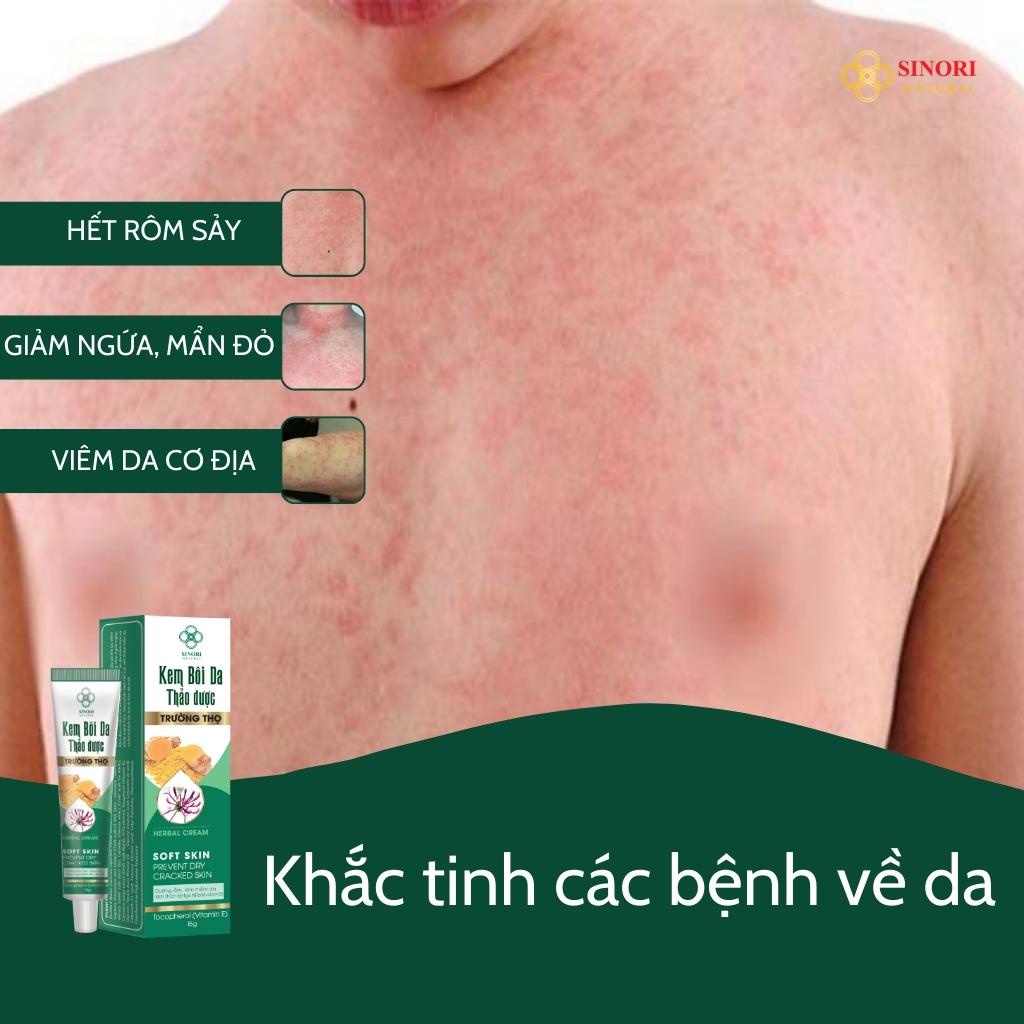 KEM BÔI DA THẢO DƯỢC SINORI