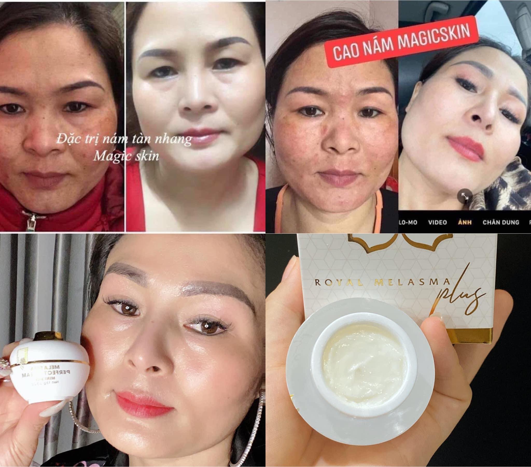 Kem nám Magic skin - Cao nám hoàng cung