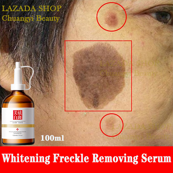 100ml Tinh chất dưỡng trắng serum Xóa nám nhanh chóng Tinh chất dưỡng ẩm dưỡng trắng sáng da loại bỏ nếp nhăn và nám thu nhỏ lỗ chân