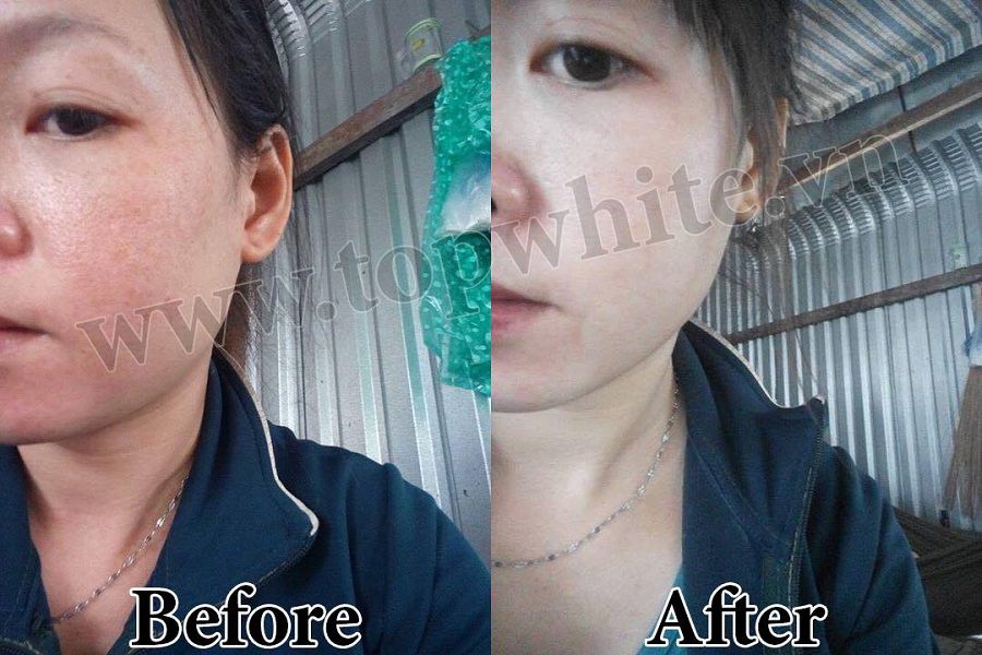[HCM]WHITE PERFECT D2 KEM DƯỠNG TRẮNG DA BAN ĐÊM